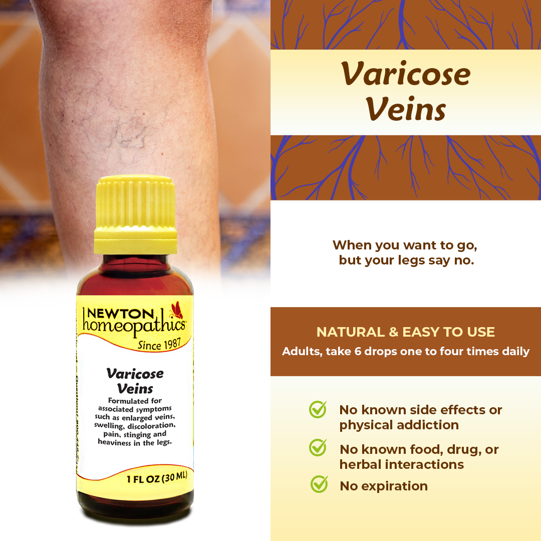 Varicose Veins