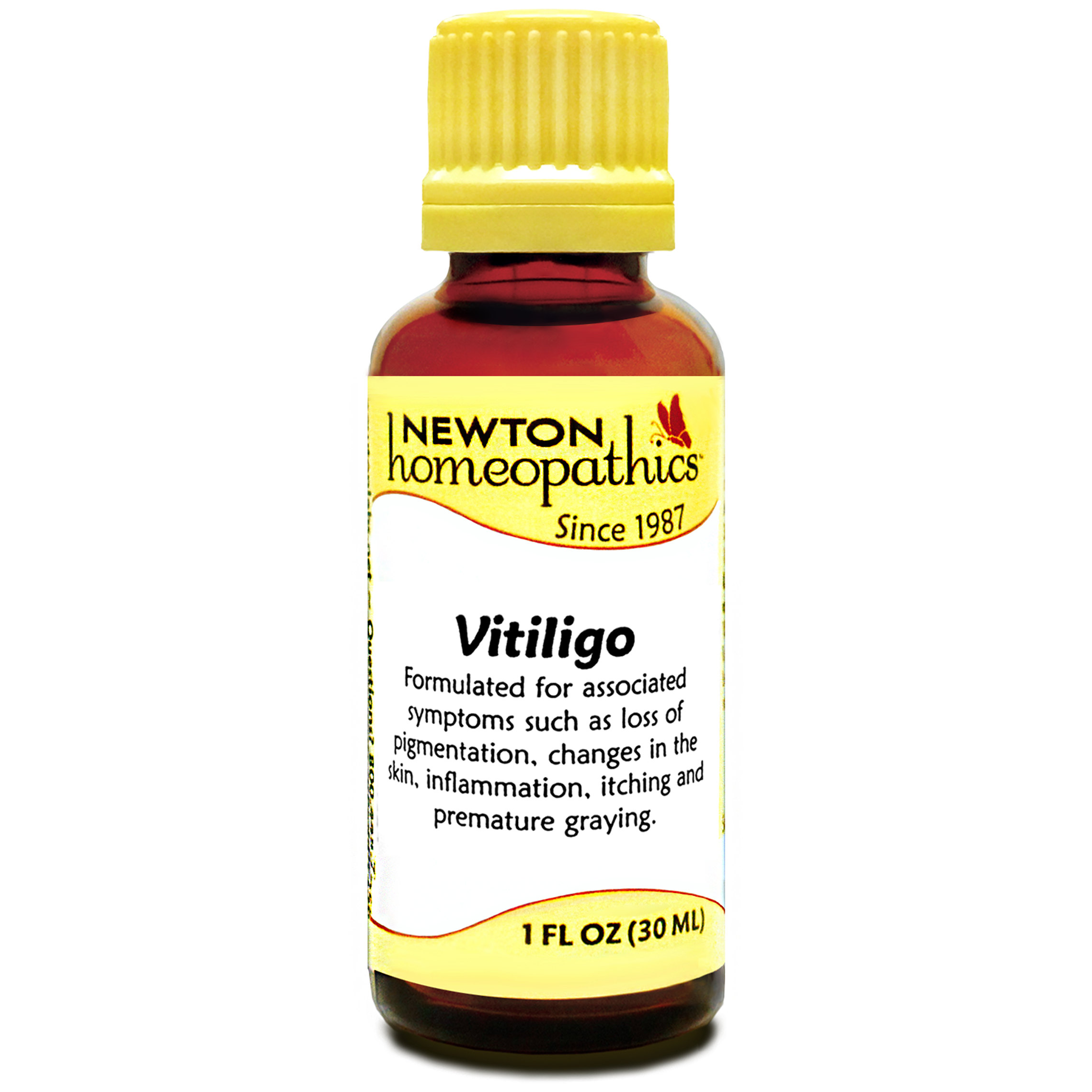 Vitiligo